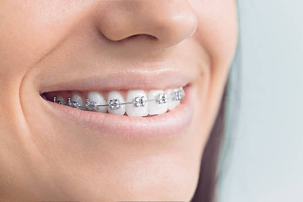 Best Invisalign and Clear Aligners  in Hempstead, TX
